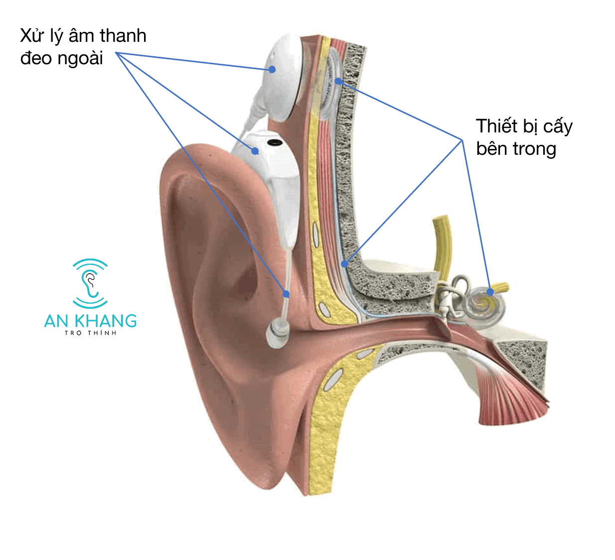 CƠ CHẾ NGHE CỦA TAI NGƯỜI Trợ thính An Khang