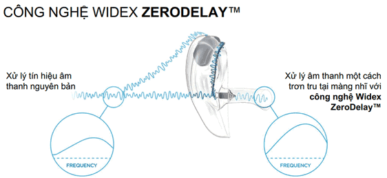 widex moment âm thanh hoàn hảo