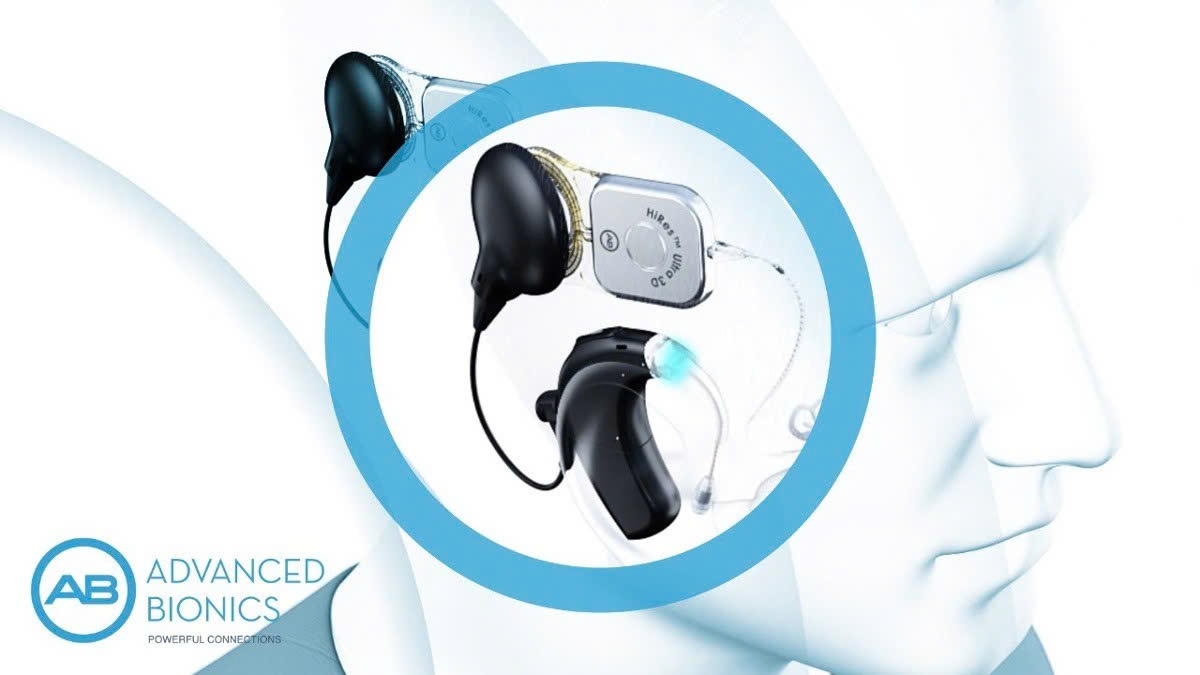 ỐC TAI ĐIỆN TỬ ADVANCED BIONICS (AB) &bull; 1