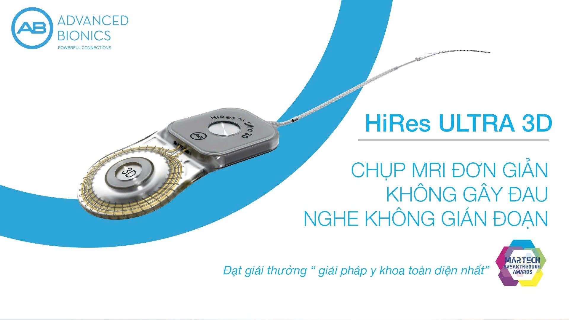 ỐC TAI ĐIỆN TỬ ADVANCED BIONICS (AB) &bull; 3