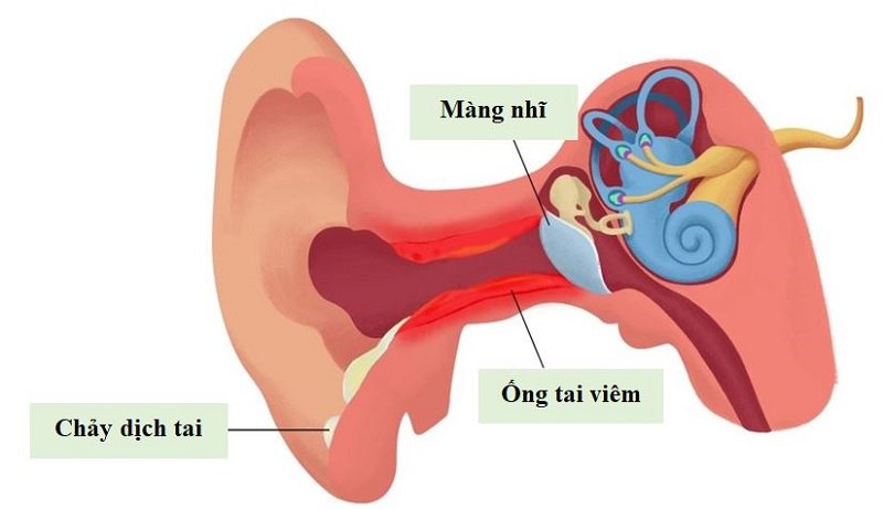 Các bệnh về tai thường gặp - cấu tạo tai