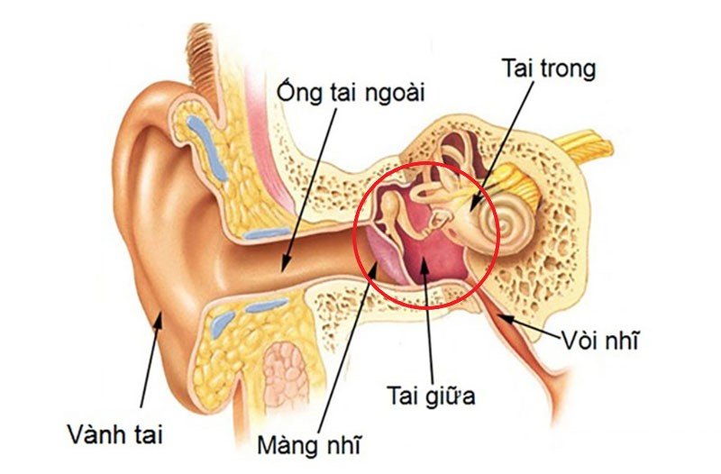 các bệnh về tai thường gặp - Viêm tai giữa