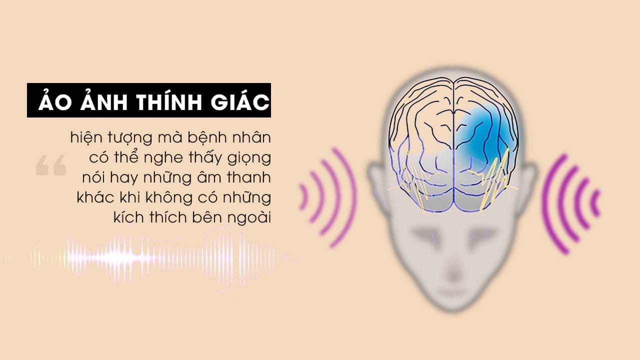 Âm thanh trong não hay từ bên ngoài? – Hiện tượng ảo thính là gì? &bull; ao anh thinh giac bat nguon tu nhung ket noi bat thuong o nao bo 1